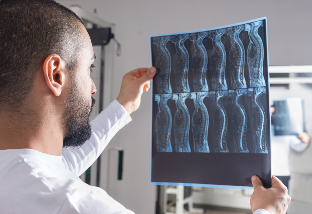 Radiologist analysing an X-ray image, symbolizing that the value of a claim, including medical expenses, is one of the six questions to ask your spinal cord injury lawyer.